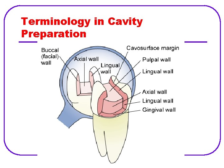 Terminology in Cavity Preparation 