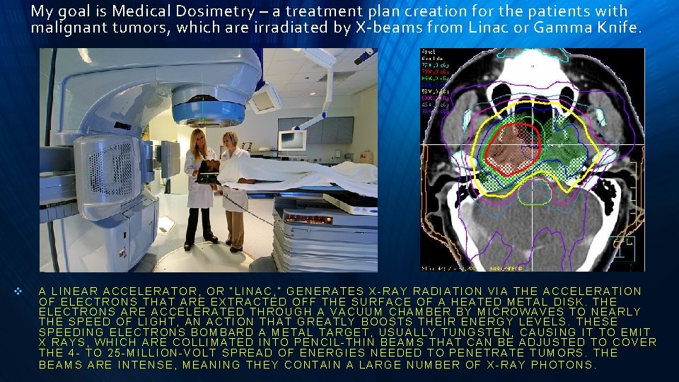 My goal is Medical Dosimetry – a treatment plan creation for the patients with
