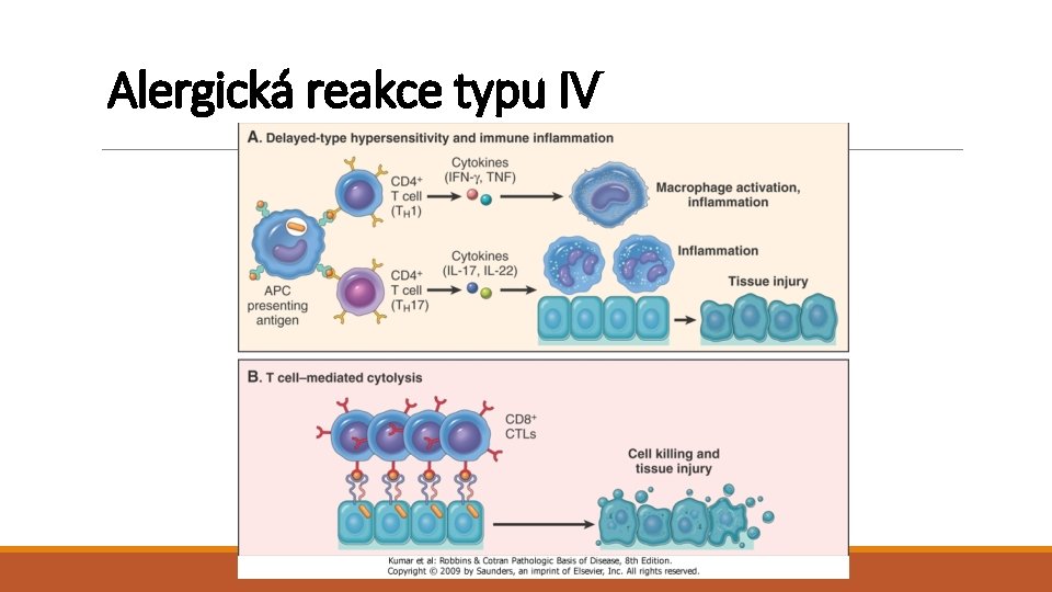 Alergická reakce typu IV 