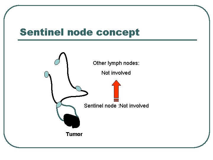 Sentinel node concept Other lymph nodes: Not involved Sentinel node : Not involved Tumor Sentinel node concept Other lymph nodes: Not involved Sentinel node : Not involved Tumor
