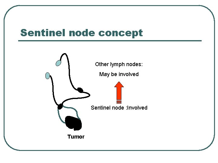 Sentinel node concept Other lymph nodes: May be involved Sentinel node : Involved Tumor Sentinel node concept Other lymph nodes: May be involved Sentinel node : Involved Tumor