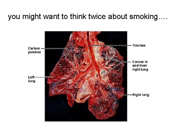 you might want to think twice about smoking…. 58 