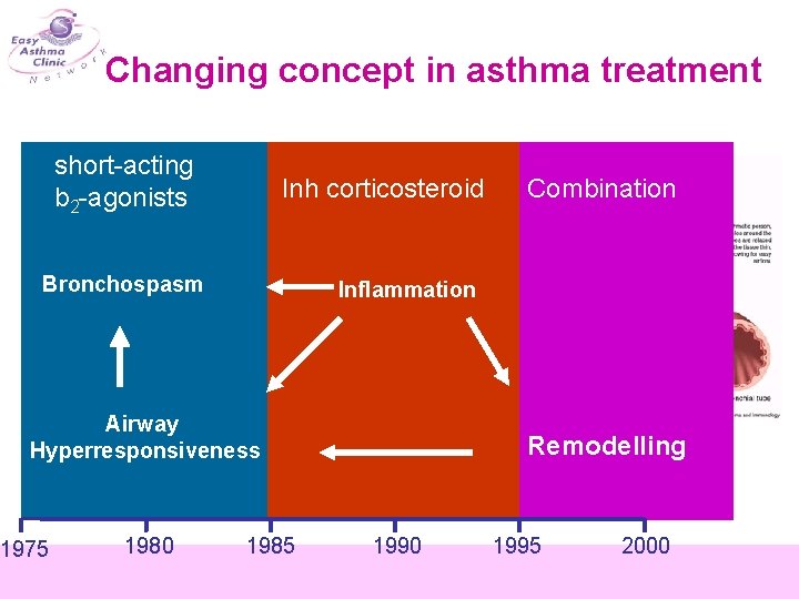 Changing concept in asthma treatment short-acting b 2 -agonists Inh corticosteroid Bronchospasm Inflammation Airway