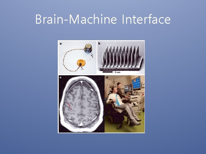 Brain-Machine Interface 