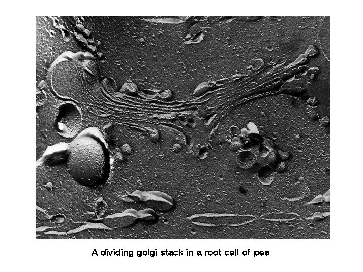 A dividing golgi stack in a root cell of pea A dividing golgi stack in a root cell of pea