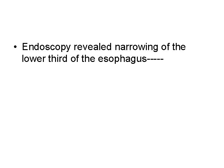 • Endoscopy revealed narrowing of the lower third of the esophagus----- • Endoscopy revealed narrowing of the lower third of the esophagus-----
