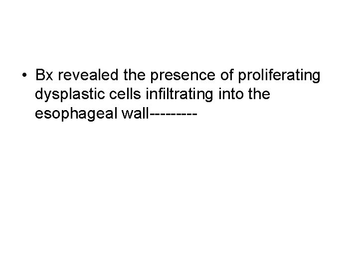 • Bx revealed the presence of proliferating dysplastic cells infiltrating into the esophageal • Bx revealed the presence of proliferating dysplastic cells infiltrating into the esophageal