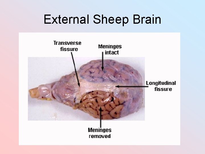 External Sheep Brain 