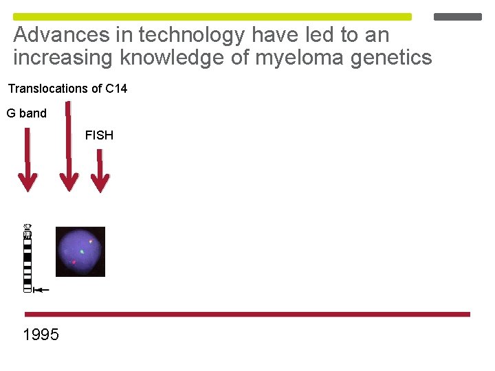 Advances in technology have led to an increasing knowledge of myeloma genetics Translocations of Advances in technology have led to an increasing knowledge of myeloma genetics Translocations of