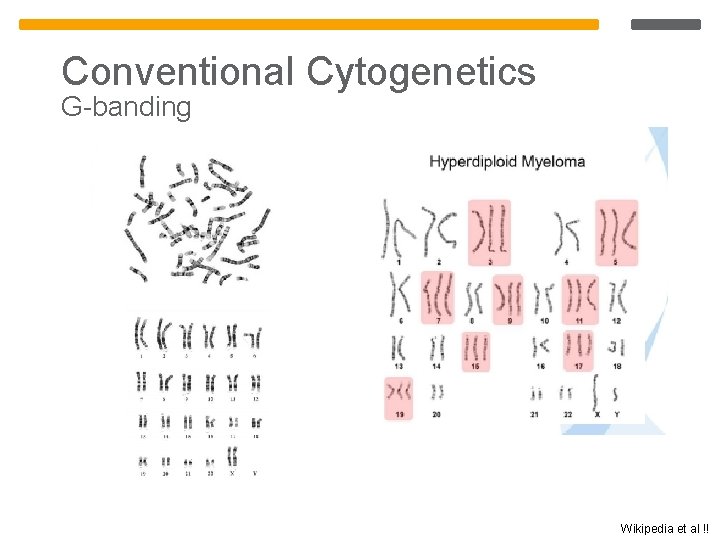 Conventional Cytogenetics G-banding Wikipedia et al !! Conventional Cytogenetics G-banding Wikipedia et al !!