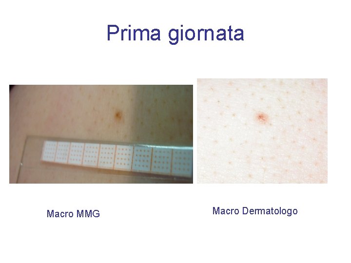 Prima giornata Macro MMG Macro Dermatologo 