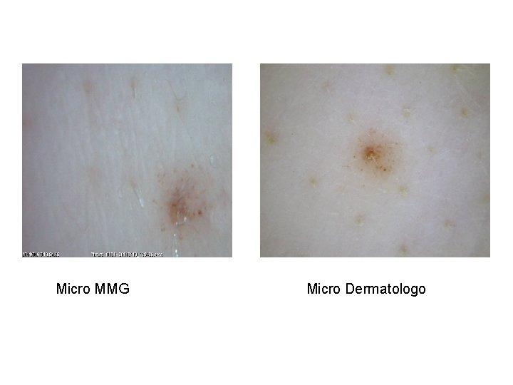 Micro MMG Micro Dermatologo 