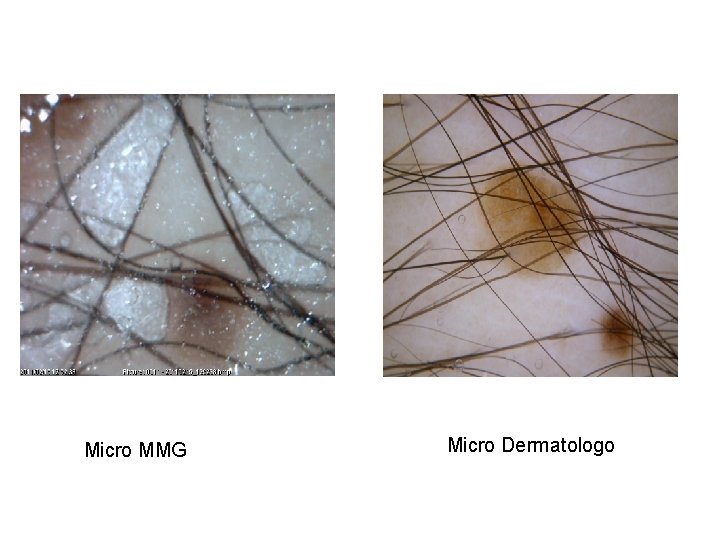 Micro MMG Micro Dermatologo 