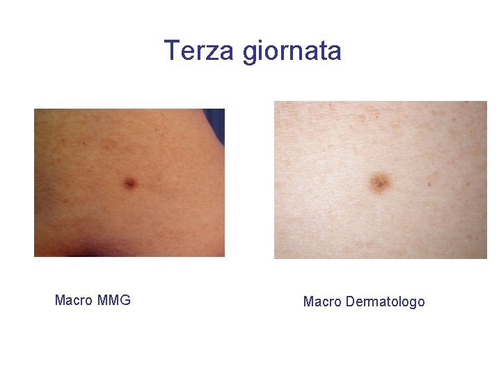 Terza giornata Macro MMG Macro Dermatologo 