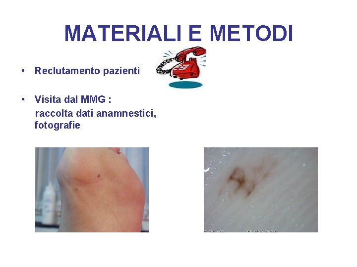 MATERIALI E METODI • Reclutamento pazienti • Visita dal MMG : raccolta dati anamnestici,