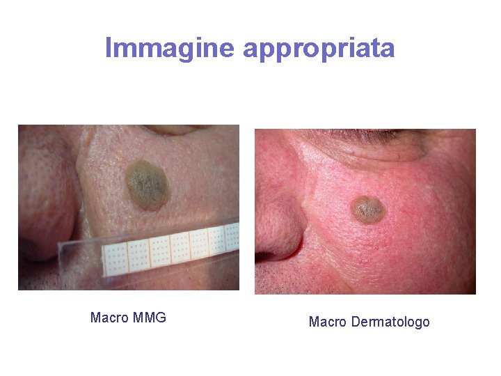 Immagine appropriata Macro MMG Macro Dermatologo 