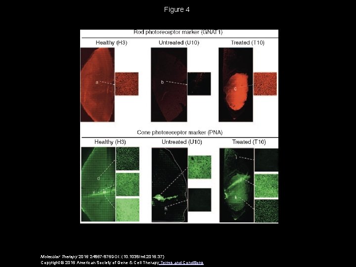 Figure 4 Molecular Therapy 2016 24867 -876 DOI: (10. 1038/mt. 2016. 37) Copyright ©