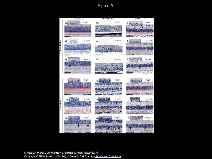 Figure 5 Molecular Therapy 2016 24867 -876 DOI: (10. 1038/mt. 2016. 37) Copyright ©