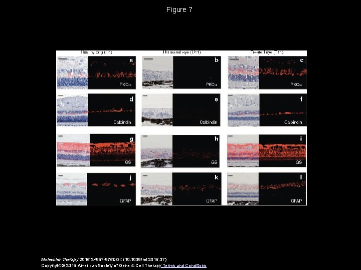 Figure 7 Molecular Therapy 2016 24867 -876 DOI: (10. 1038/mt. 2016. 37) Copyright ©