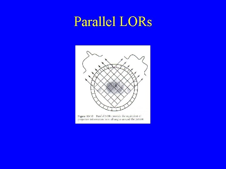 Parallel LORs 