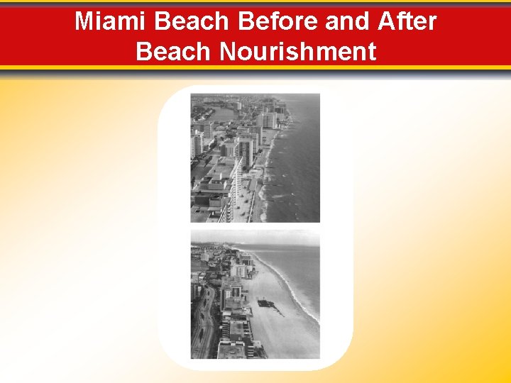 Miami Beach Before and After Beach Nourishment 