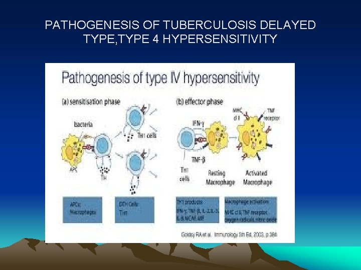 PATHOGENESIS OF TUBERCULOSIS DELAYED TYPE, TYPE 4 HYPERSENSITIVITY 