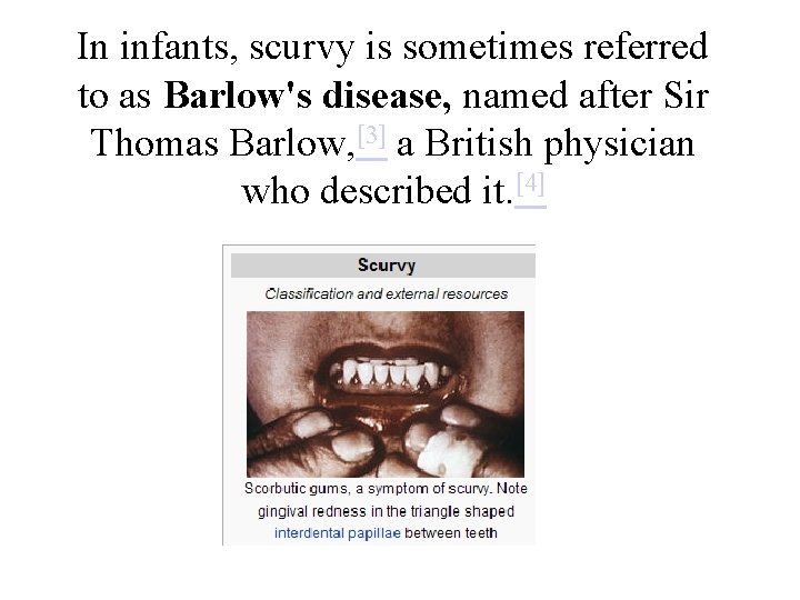 In infants, scurvy is sometimes referred to as Barlow's disease, named after Sir Thomas