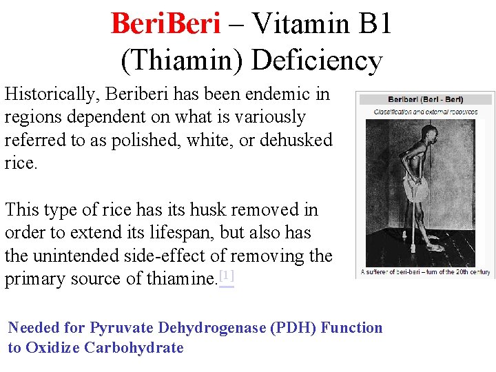 Beri – Vitamin B 1 (Thiamin) Deficiency Historically, Beriberi has been endemic in regions