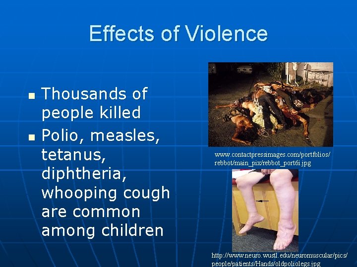 Effects of Violence n n Thousands of people killed Polio, measles, tetanus, diphtheria, whooping