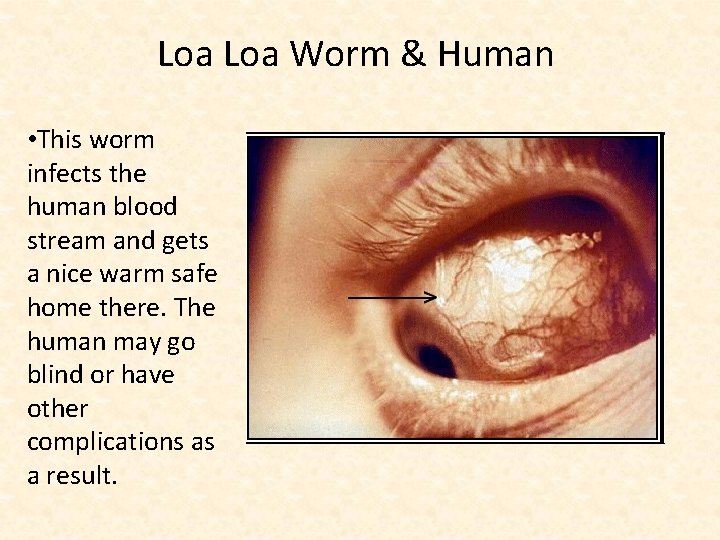 Loa Worm & Human • This worm infects the human blood stream and gets