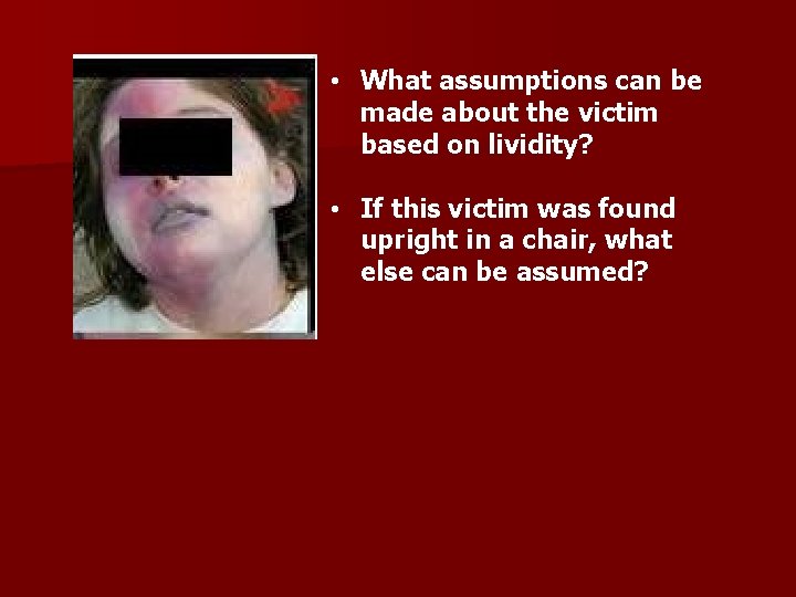  • What assumptions can be made about the victim based on lividity? •