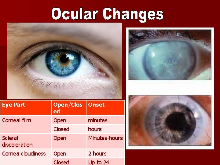 Eye Part Open/Clos ed Onset Corneal film Open minutes Closed hours Scleral discoloration Open