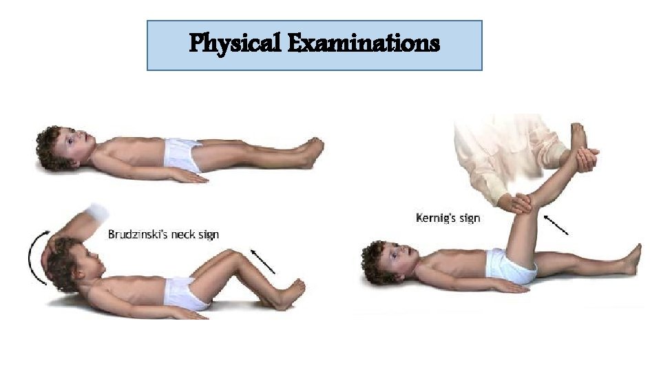 Physical Examinations 