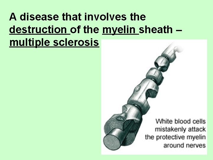 A disease that involves the destruction of the myelin sheath – multiple sclerosis 
