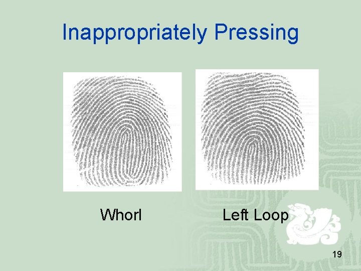 Inappropriately Pressing Whorl Left Loop 19 Inappropriately Pressing Whorl Left Loop 19