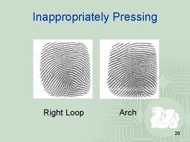 Inappropriately Pressing Right Loop Arch 20 Inappropriately Pressing Right Loop Arch 20