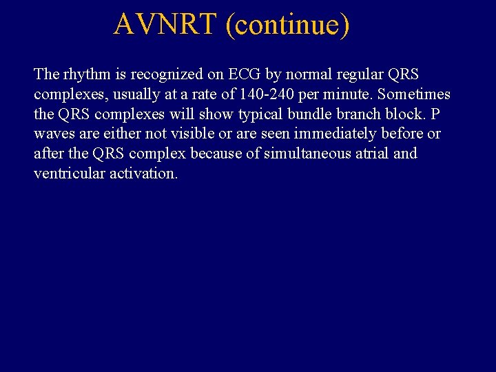 AVNRT (continue) The rhythm is recognized on ECG by normal regular QRS complexes, usually
