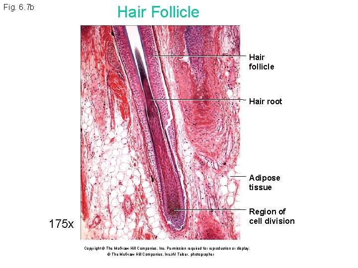 Fig. 6. 7 b Hair Follicle Hair follicle Hair root Adipose tissue 175 x