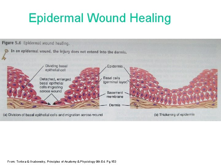Epidermal Wound Healing From: Tortora & Grabowsky, Principles of Anatomy & Physiology 9 th