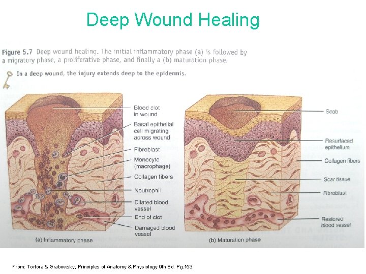 Deep Wound Healing From: Tortora & Grabowsky, Principles of Anatomy & Physiology 9 th