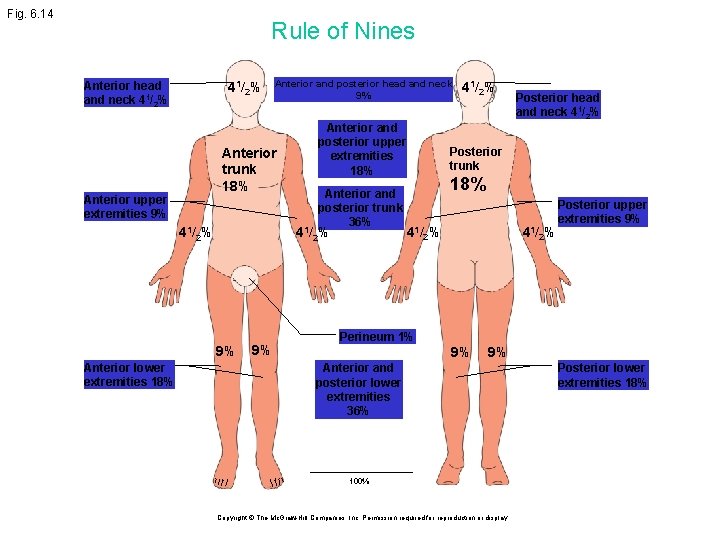 Fig. 6. 14 Rule of Nines Anterior head and neck 41/2% Anterior trunk 18%