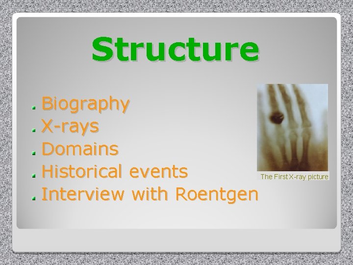 Structure Biography X-rays Domains Historical events Interview with Roentgen The First X-ray picture 