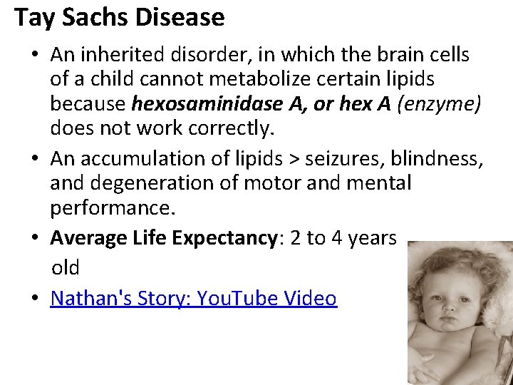 Tay Sachs Disease • An inherited disorder, in which the brain cells of a