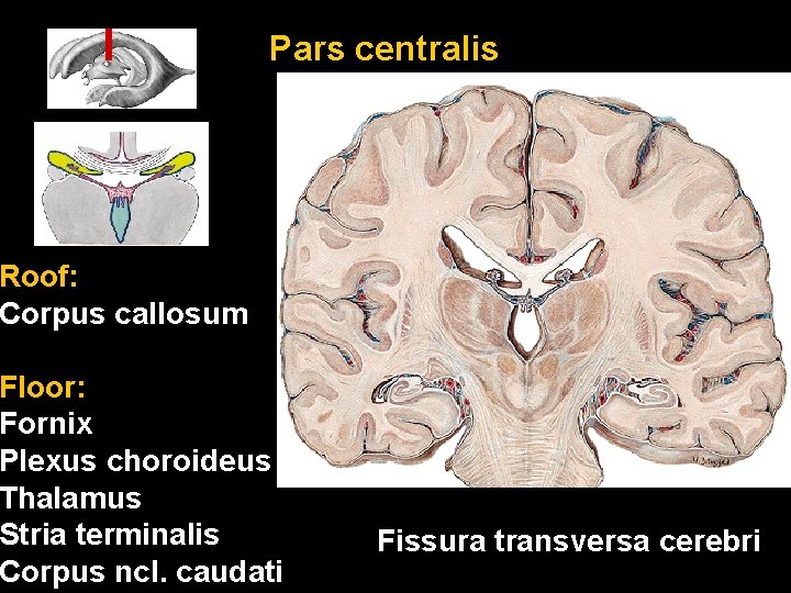 Pars centralis Roof: Corpus callosum Floor: Fornix Plexus choroideus Thalamus Stria terminalis Corpus ncl.