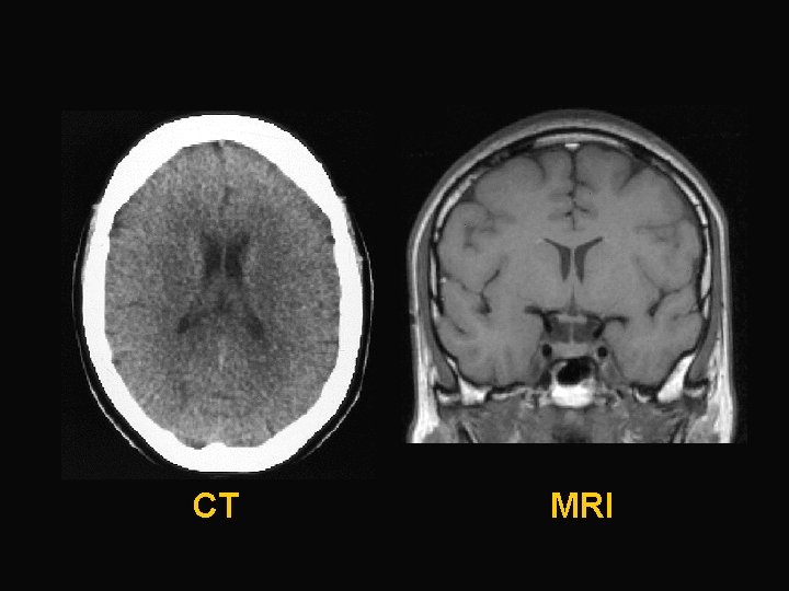 CT MRI 