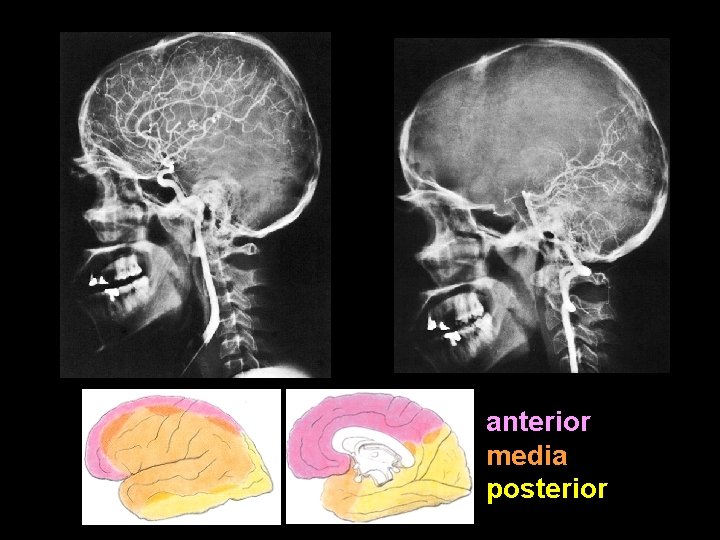 anterior media posterior 