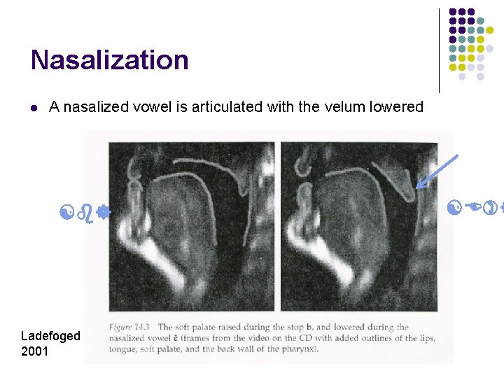 Nasalization l A nasalized vowel is articulated with the velum lowered [b] Ladefoged 2001