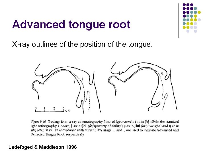 Advanced tongue root X-ray outlines of the position of the tongue: Ladefoged & Maddieson