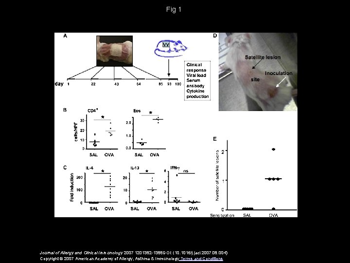 Fig 1 Journal of Allergy and Clinical Immunology 2007 1201382 -1388 DOI: (10. 1016/j.