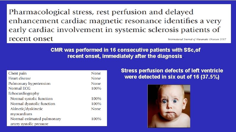 CMR was performed in 16 consecutive patients with SSc, of recent onset, immediately after